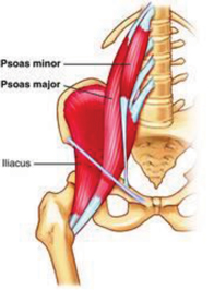 etirement Psoas-Iliaque droit